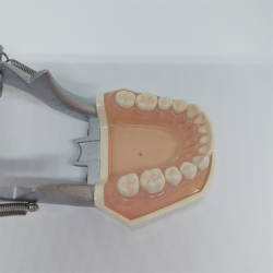 Studiemodel med Aftagelige Tnder 